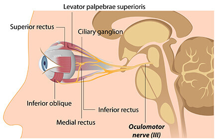 Oculomotor nerve dysfunction